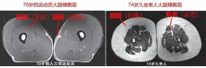 運(yùn)動是加速衰老，還是延緩衰老？真相揭開